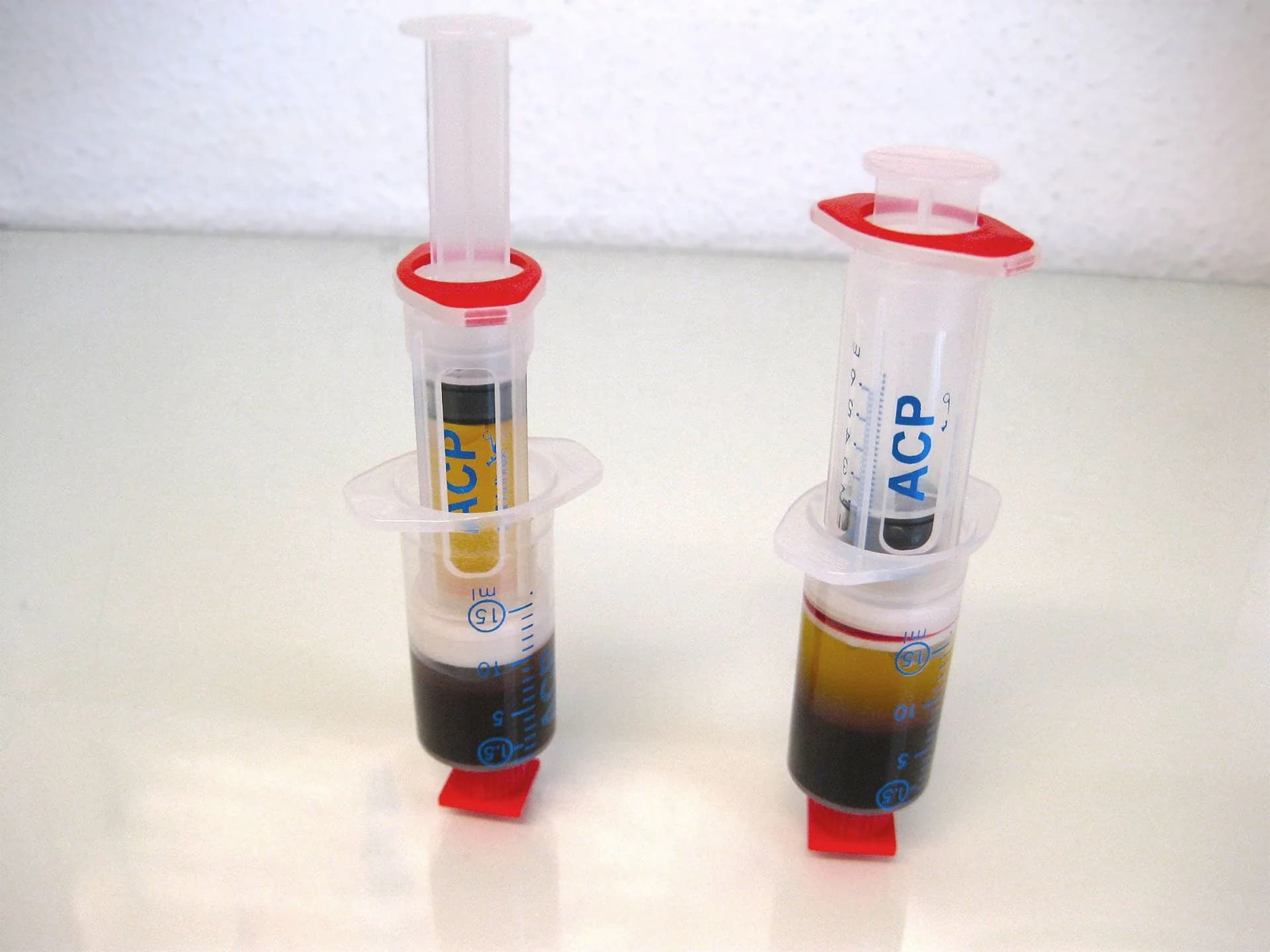 Zwei ACP-Spritzen mit sichtbar getrennten Blutphasen – dunkle Blutzellen unten, goldenes Plasma oben